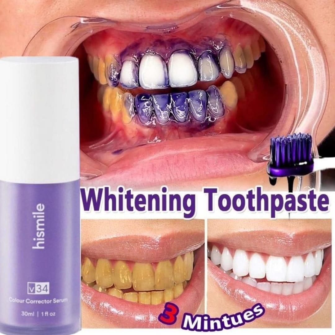 Teeth Whitening  Pack of 1